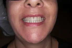 fixed porcelain before 1