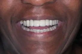 reconstructive after 1