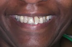 reconstructive before 1